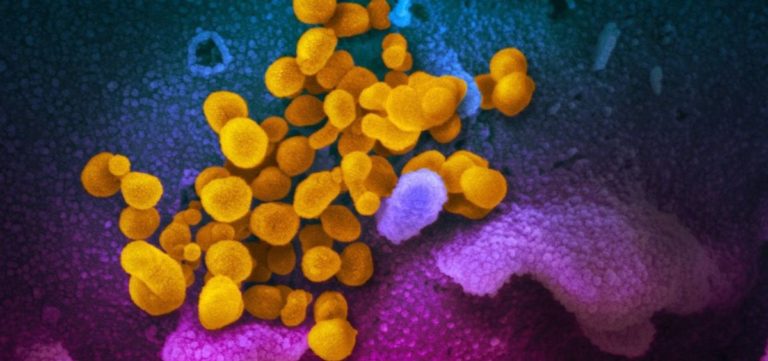 Los anticuerpos podrían predecir la evolución del covid en los no vacunados