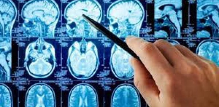 Una nueva resonancia permitirá anticipar patologías neurodegenerativas