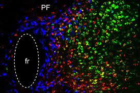 Circuitos encontrados en el tálamo podrían ayudar a tratar la enfermedad de parkinson