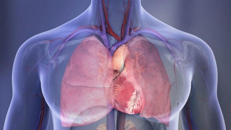 Contaminación podría estar aumentado el riesgo de ataques cardíacos